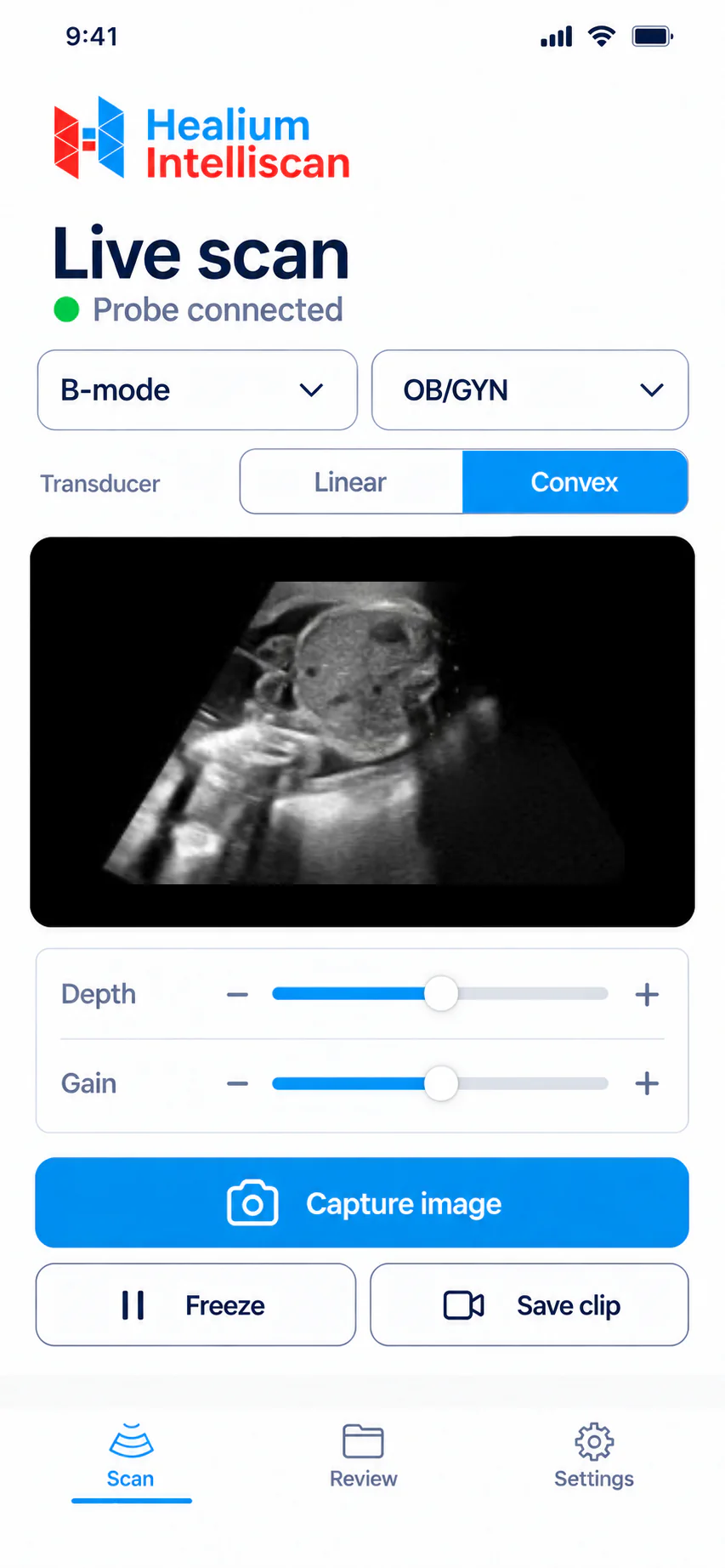 Live scan on a phone — OB/GYN, convex array