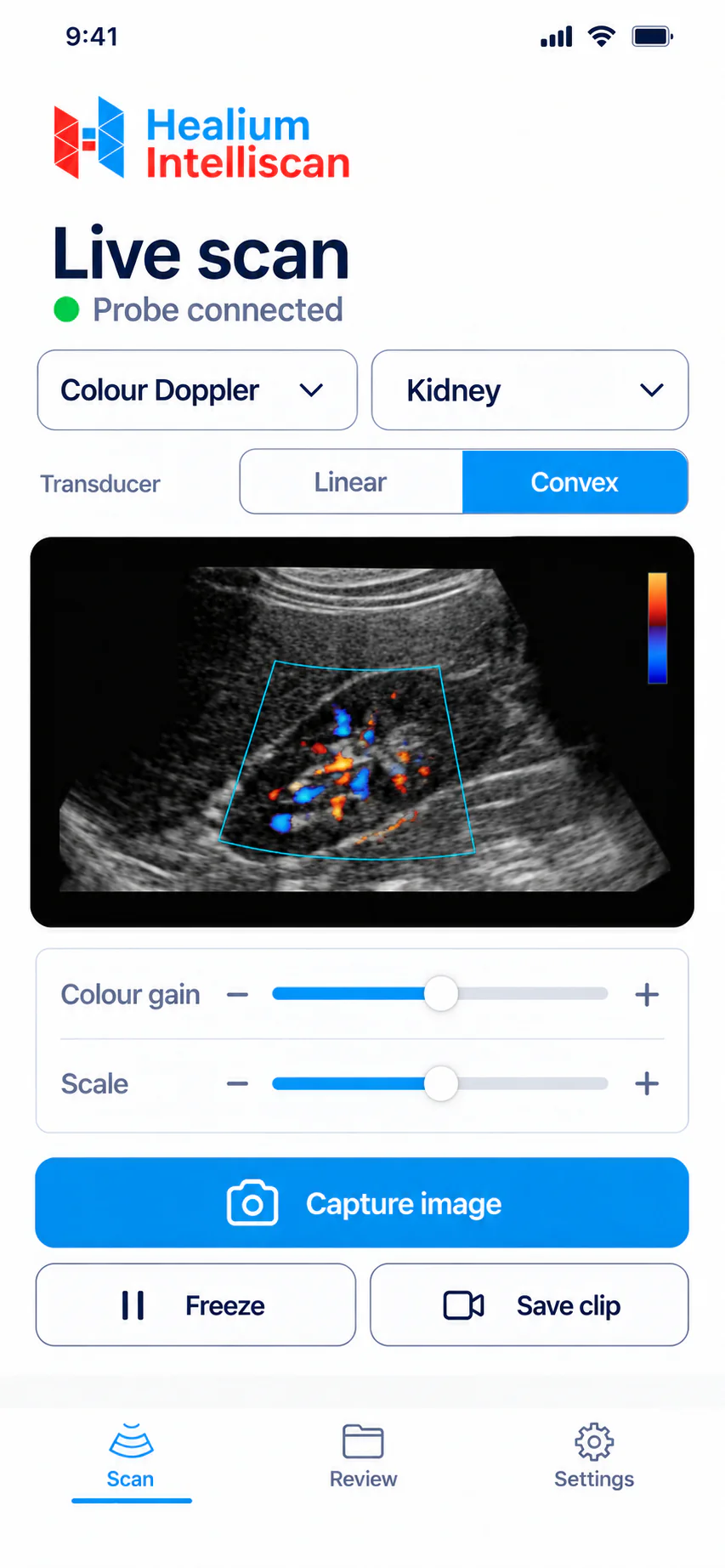 Colour Doppler on a live scan