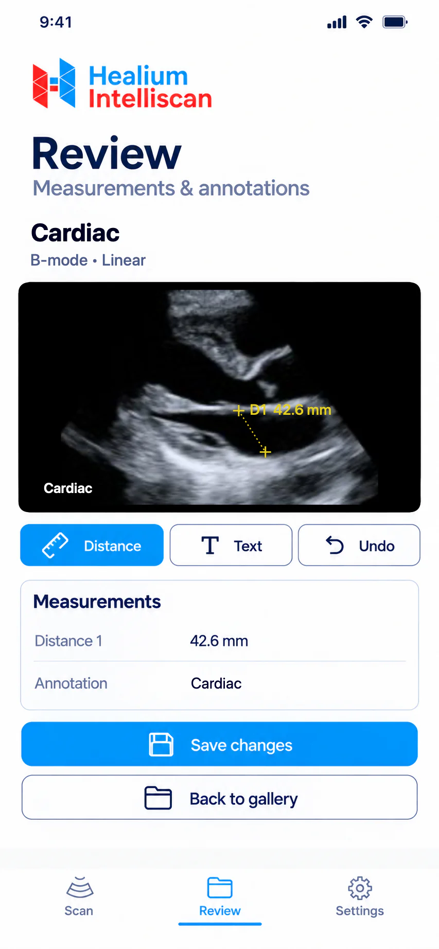 Measurements and annotations on a cardiac frame