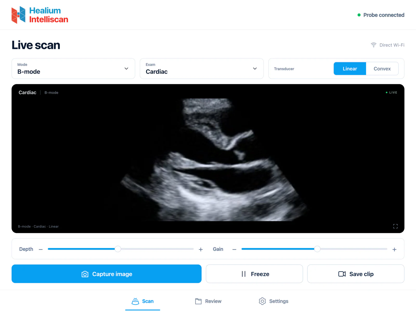 Live scan on a tablet — cardiac, linear array