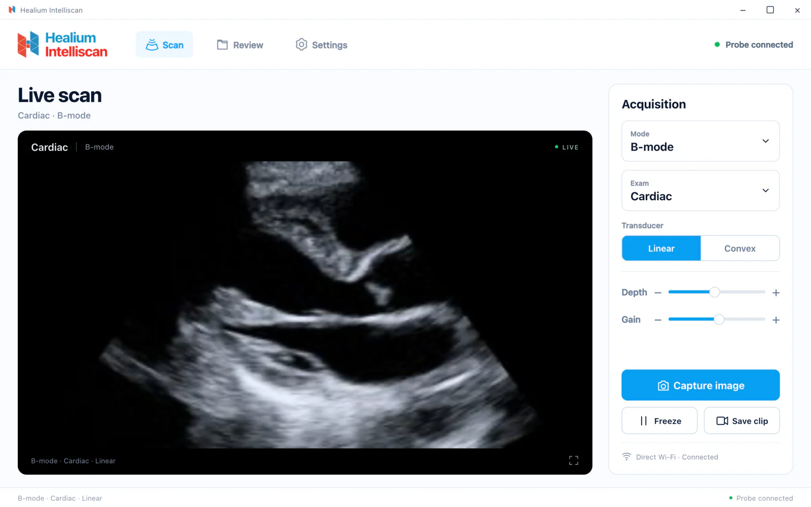 Live scan in the Windows desktop app