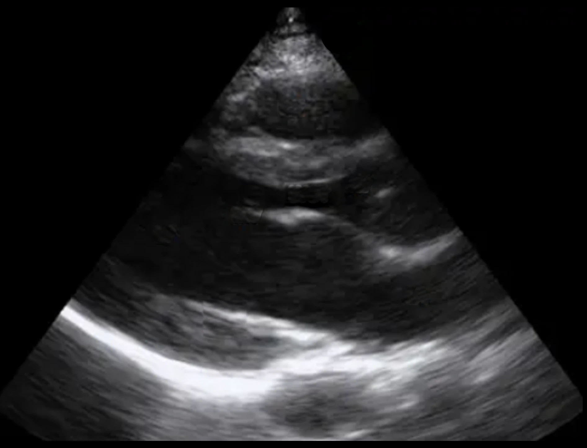 Cardiac B-mode frame from the linear array