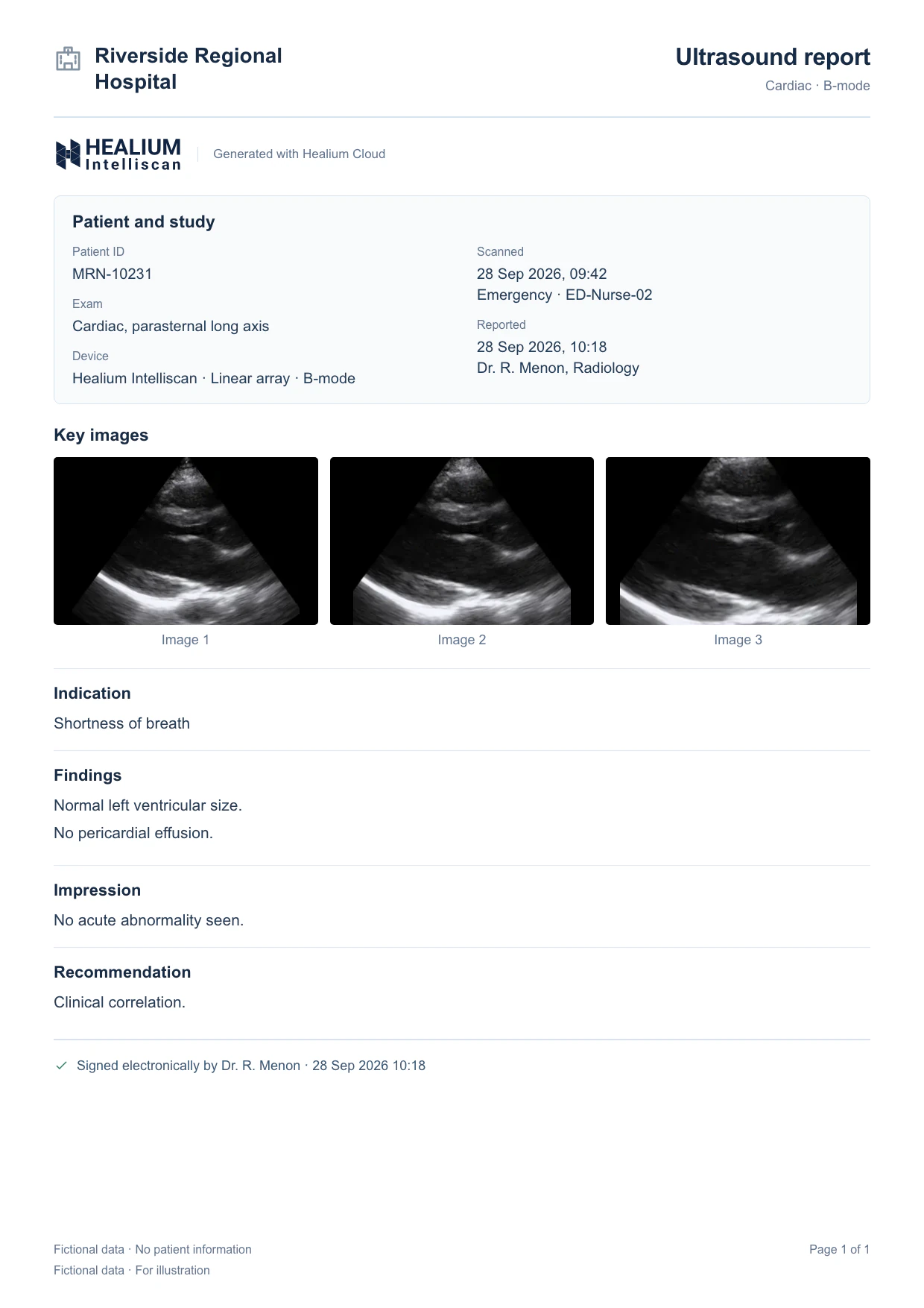 Sample Healium Cloud ultrasound report: patient and study details, three key images, indication, findings, impression and electronic signature (fictional data)