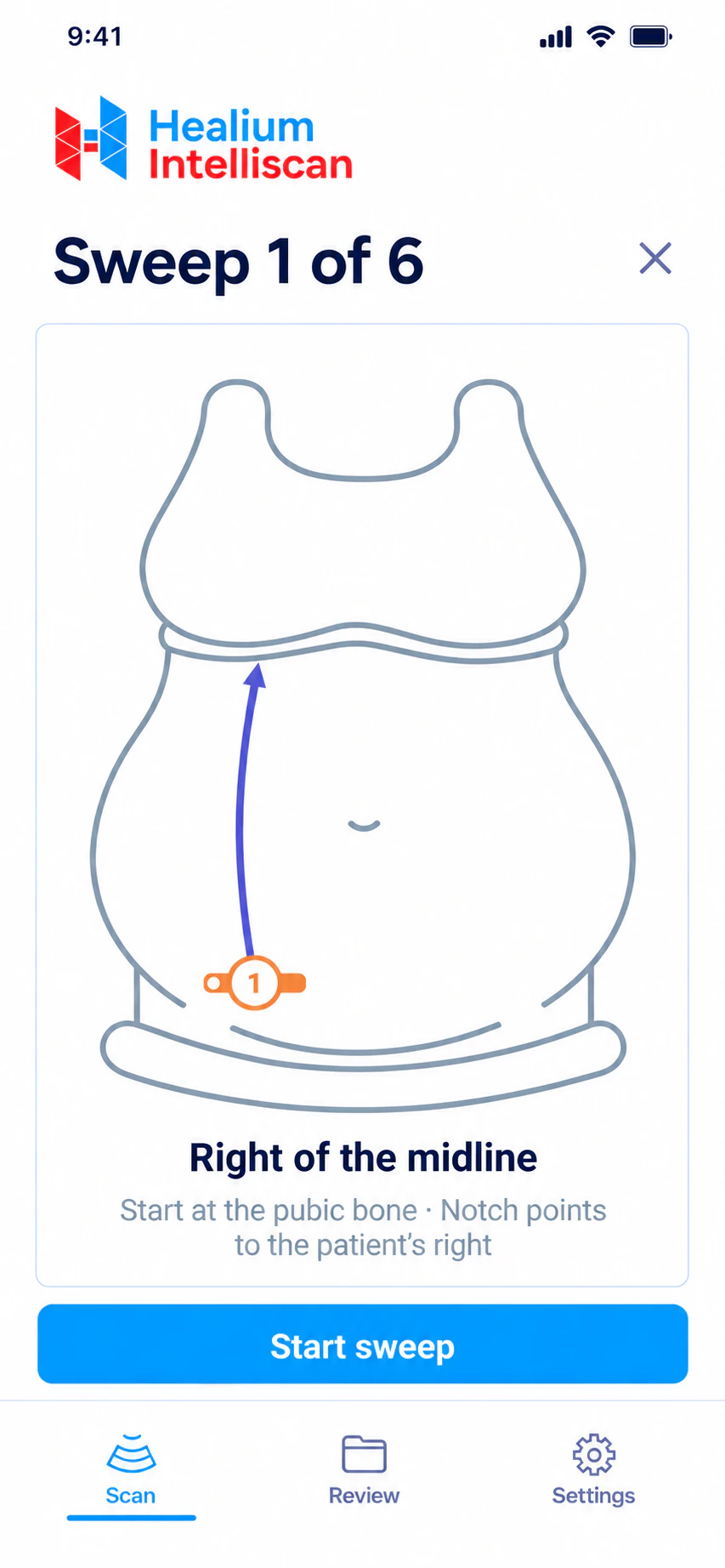 Healium Intelliscan app, Guided OB Sweep: sweep 1 of 6, right of the midline